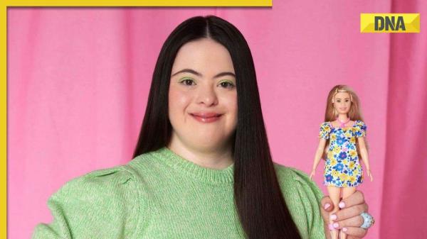 What is Down Syndrome, a co<em></em>ndition new edition of Barbie portrays?